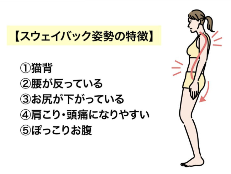 藤井寺市で産後の姿勢の問題はなごむ整体院にお任せください。